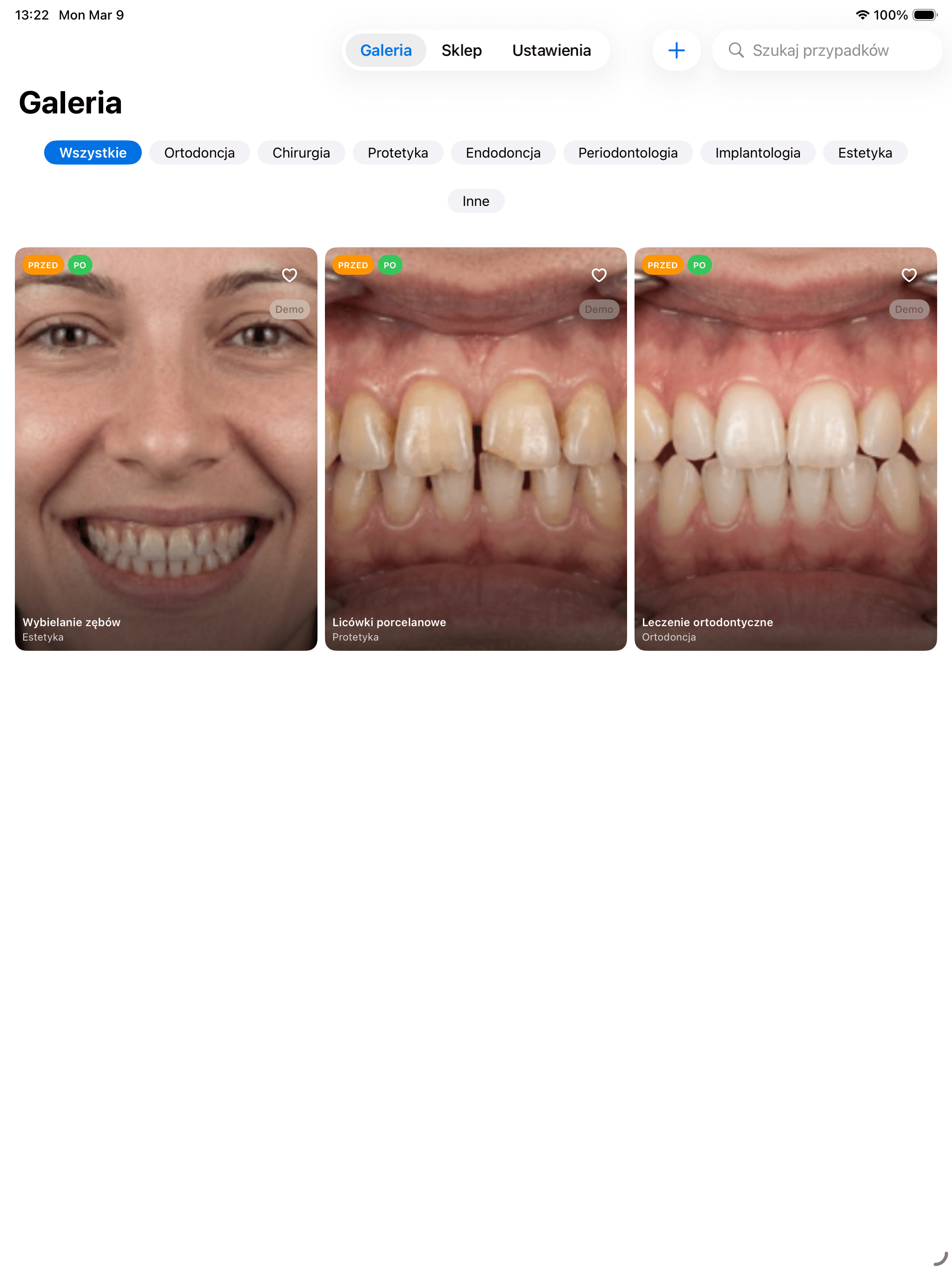Dental gallery app interface featuring treatment categories and three cards showing patient smile transformations.